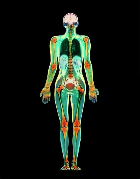 Coloured Mri Scan Of A Whole Human Body Female Photograph By Simon
