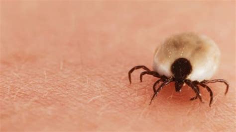 How To Treat Tick Bites The Tick And Mosquito Project