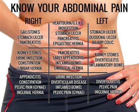 Abdominal Pain Causes And Treatment Matthew Eidem Md