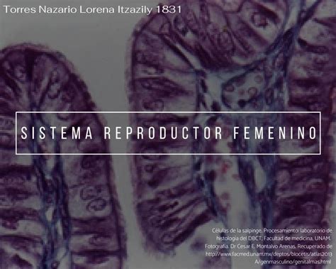 Sistema Reproductor Femenino Tnli Udocz