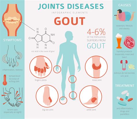 Gout — Foot And Ankle Centers