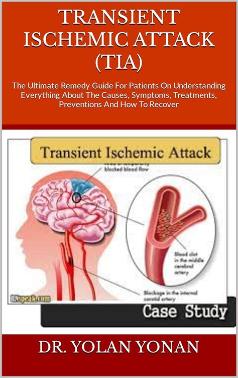 Transient Ischemic Attack Tia The Ultimate Remedy Guide For