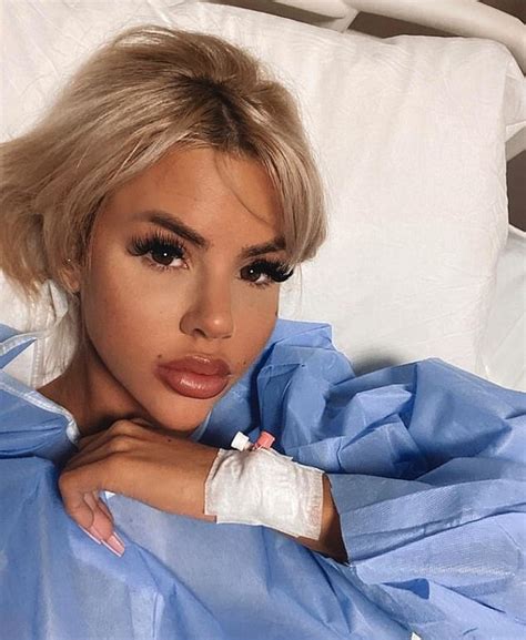 Love Islands Hannah Elizabeth Reveals The Shocking Results Of Her Facial Surgery Daily Mail