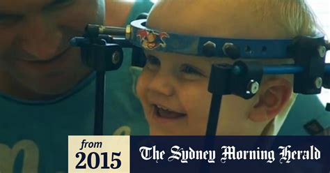 Video Toddlers Head Successfully Reattached To Spine