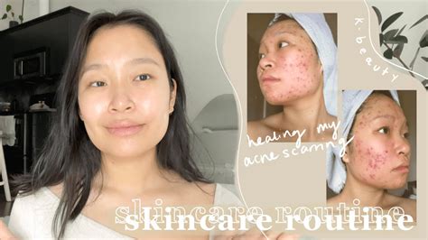 My Holy Grail Skincare Routine How I Healed My Severe Acne Scarring