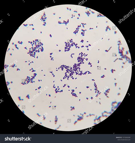 Bacteria Gram Staining Under Microscopic View Stock Photo 1319269289