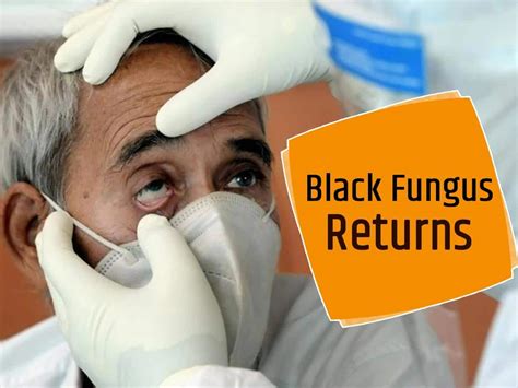 Black Fungus Infection Is Back Mumbai Bangalore Doctors Report Sudden