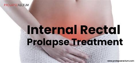 Internal Rectal Prolapse Treatment