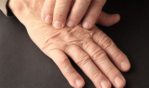 Arthritis Symptoms These Hand Exercises Could Ease Painful Joints