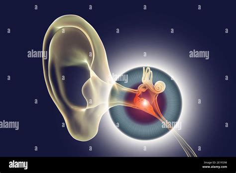 Otitis Media Infección Del Oído Ilustración Fotografía De Stock Alamy