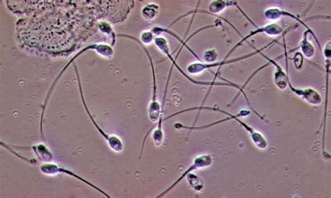 Worlds 1st Artificial Sperm Is Almost Real Will Benefit 235 Crore