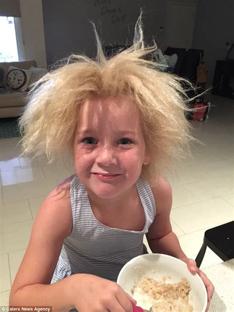 Melbourne Schoolgirl Has Unbrushable Hair Syndrome Daily Mail Online