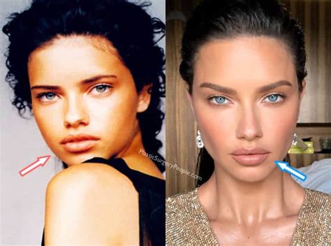 Did Adriana Lima Have Plastic Surgery Before And After 2020