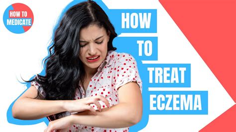 How To Treat Eczema Dermatitis Doctor Explains Youtube
