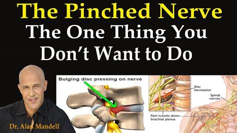 The Pinched Nerve The One Thing You Dont Want To Do Dr Mandell