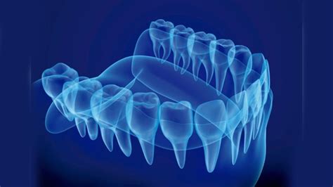 ¿qué Es La Odontología Digital Y Cómo Puede Beneficiar A Los Pacientes