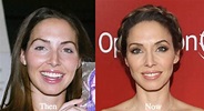 Whitney Cummings Plastic Surgery Before and After Photos - Latest ...
