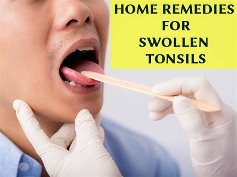 Swollen Lymph Nodes And Tonsils