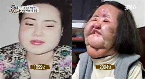 한국 성형 실패 “선풍기 아줌마” 젊을 때 미인사진 공개5 인민넷 조문판 人民网