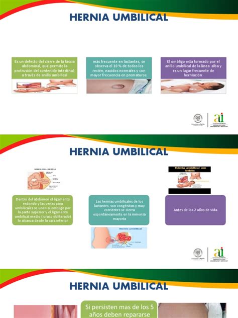 Hernia Umbilical Pdf Abdomen Peritoneo
