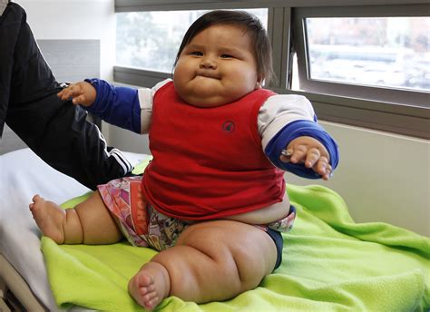 8 Month Old Compulsive Eater Weighs More Than 44 Pounds Cbs News