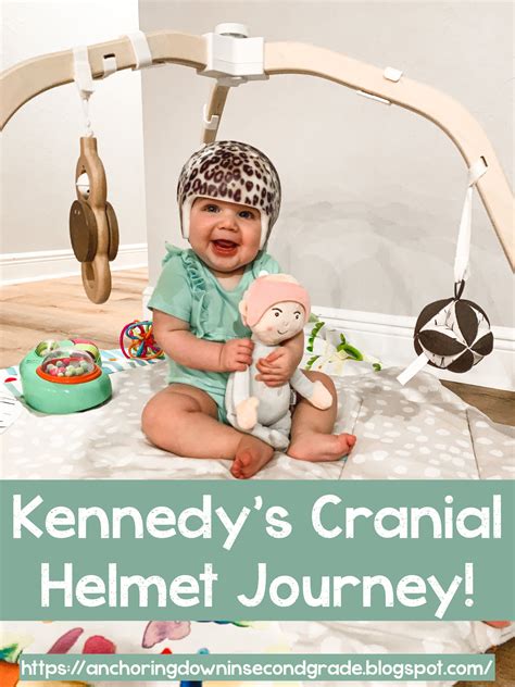 Kennedys First 5 Days In Her Cranial Helmet Baby Helmet Baby