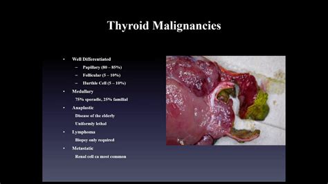 Thyroid Surgery Youtube