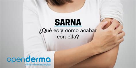 ¿qué Es La Sarna Clínica Dermatológica Murcia Openderma