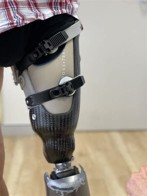Prosthetic Knee Microprocessor Controlled Knees Apc Prosthetics