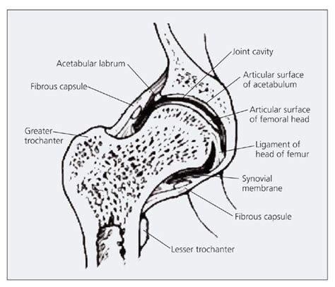 Femoroacetabular Impingement Fai In The Hip