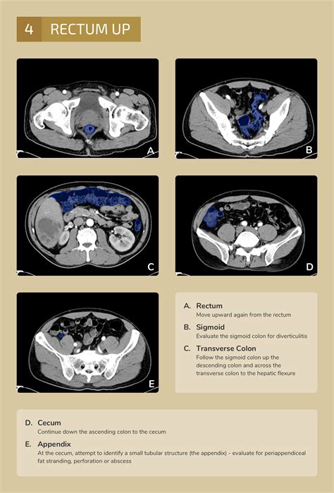 Differential Diagnosis Of Infographic Ct Abdomenpelvis Interpretation