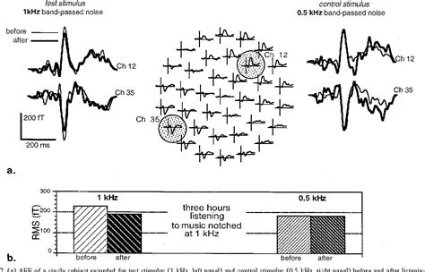 Figure 1 From Short Term Plasticity Of The Human Auditory Cortex