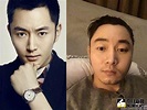 「甄嬛傳男神」面骨斷裂 談毀容想轉幕後 | 娛樂 | NOWnews今日新聞