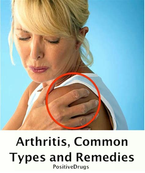 Natural Remedies For Arthritis Image By Vivian On Health Natural Cure