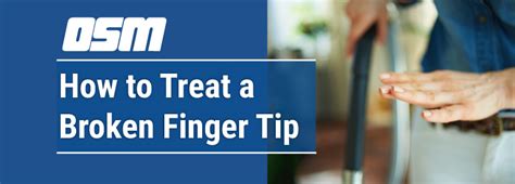 how to treat a broken finger tip orthopedic and sports medicine