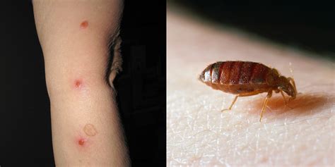 You Can Have Bed Bugs And Not Know It—heres What To Look Out For Self