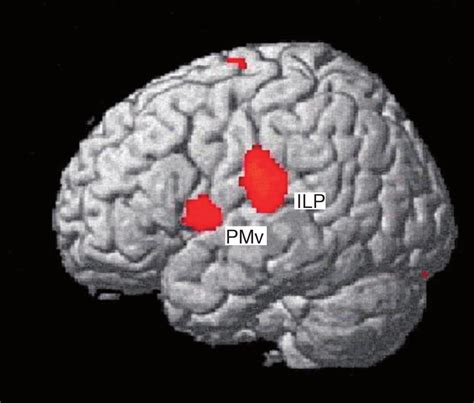 Activation Of The Left Inferior Parietal Lobule Ipl And Premotor