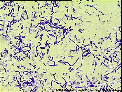 Listeria monocytogenes is a gram positive rod shaped (bacillus) bacterium. Mystery Bug 8