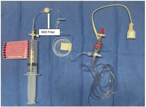 Nursing Guidelines Filters For Venous Access Lines In Select Group Of