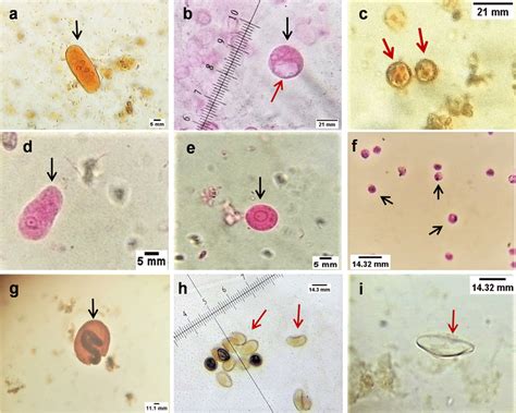 Photomicrographs Of Different Intestinal Parasites Recovered During The