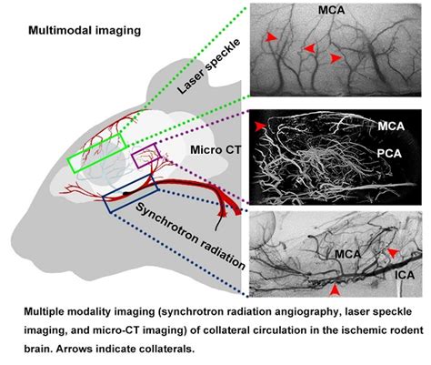 Rapamycin Increases Collateral Circulation In Rodent Brain After Focal