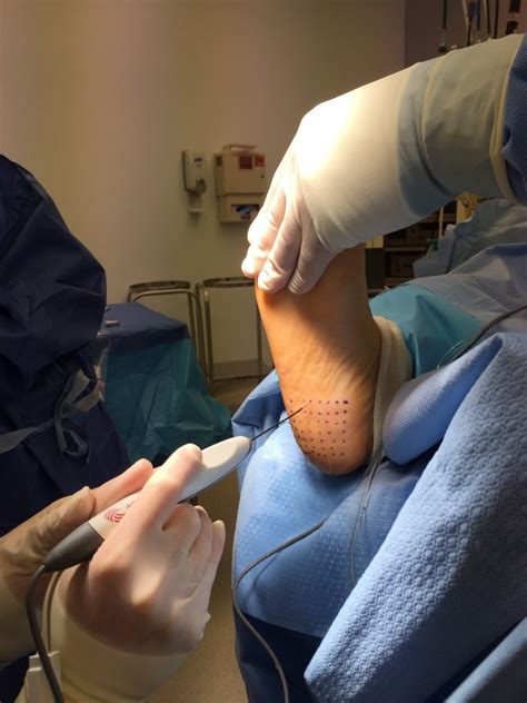 Heel Pain Treatment Alpine Foot Specialists