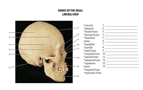 Solved Bones Of The Skull Lateral View Coronal Ethmoid Frontal