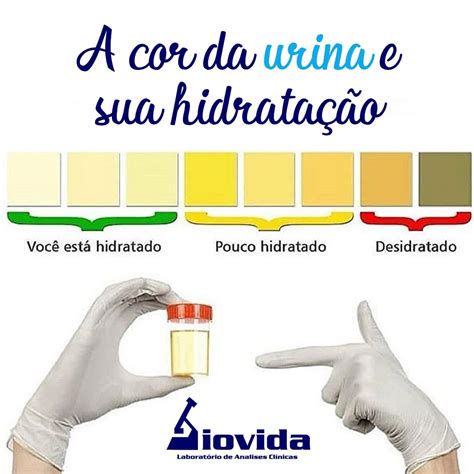 A cor da urina e sua hidratação Laboratório Biovida