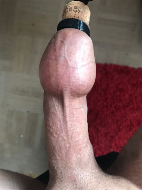 Foreskin Balloon