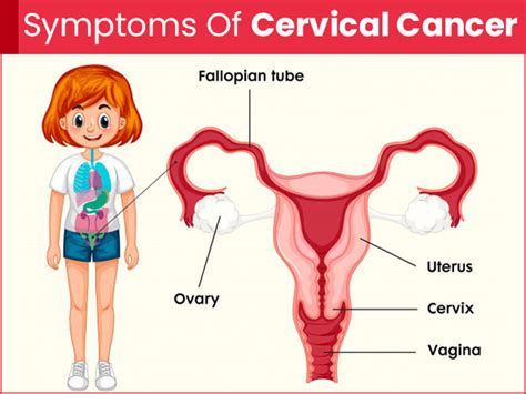 Almost all cervical cancer cases (99%) are linked to infection with although most infections with hpv resolve spontaneously and cause no symptoms, persistent infection can cause cervical cancer in women. Dysentery natural treatment - Health Breaking News