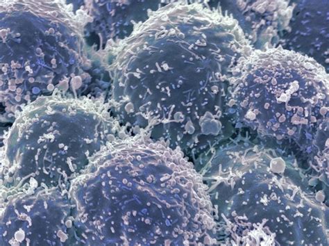 Fda Approves Pembrolizumab For Tumor Mutational Burden High Cancer