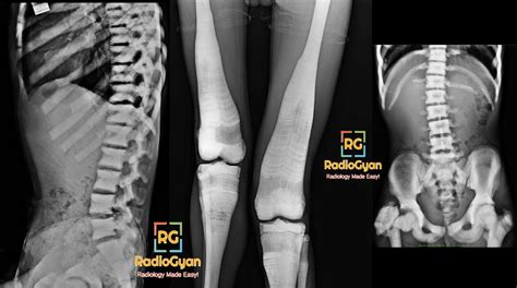 Interesting Radiology Cases Spotters Set 49 Radiogyan Radiogyan