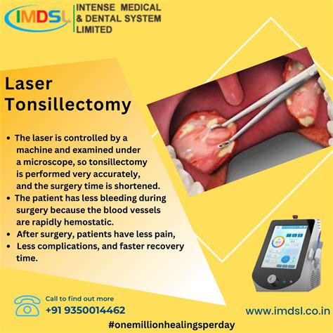 Discovering The Advantages Of Laser Tonsillectomy