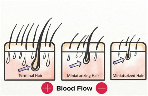 Hair loss can be a frustrating condition to deal with. Scalp Massage for Hair Growth | 2019 Guide - Hairguard